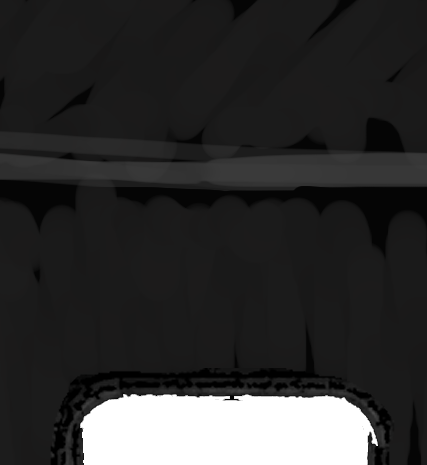 error